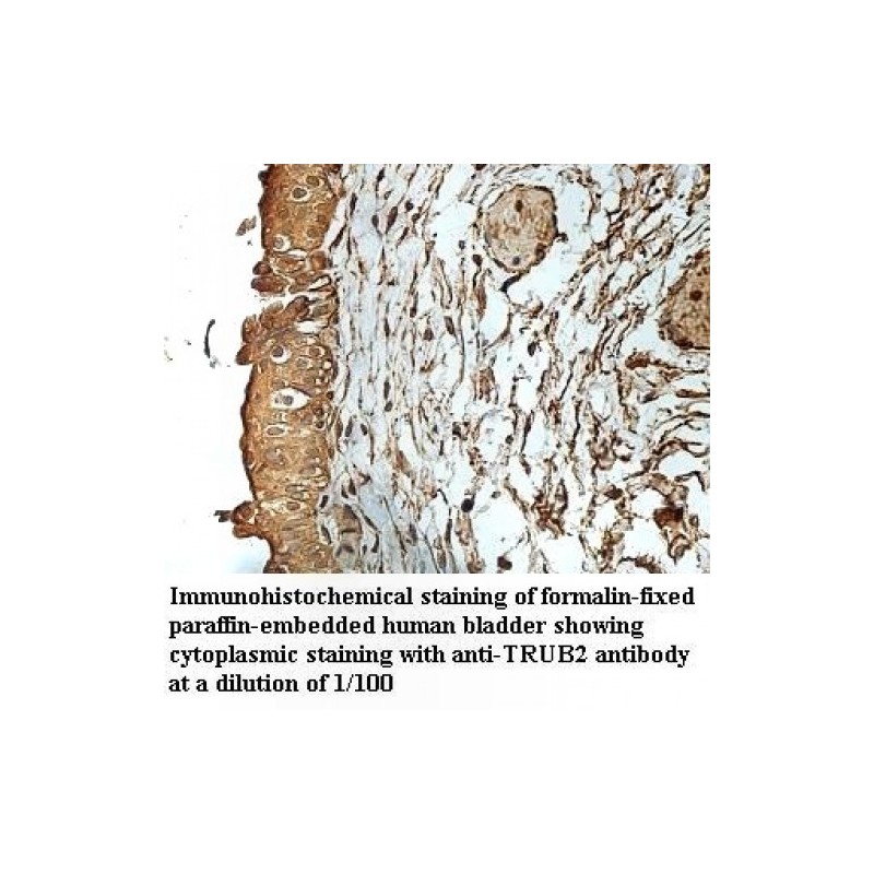 Trub Antibody Supplier Cas Aobious