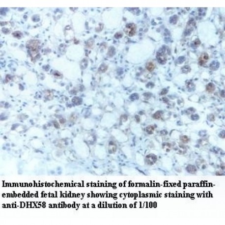 DHX58 Antibody