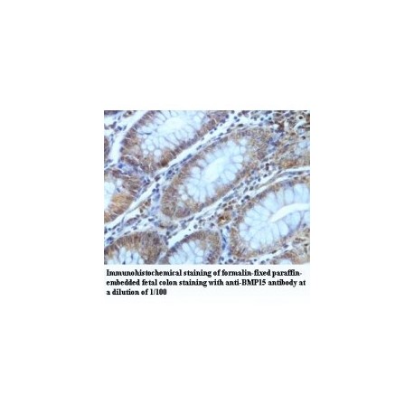 BMP15 Antibody