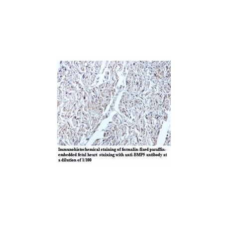 BMP5 Antibody