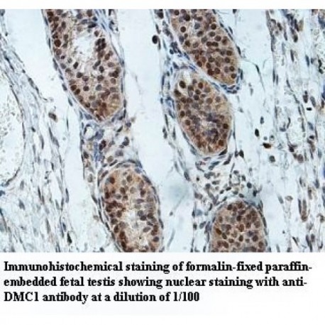 DMC1 Antibody