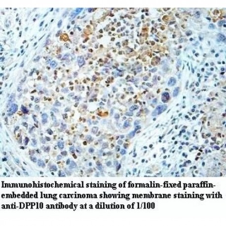 DPP10 Antibody