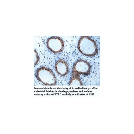 BTRC Antibody