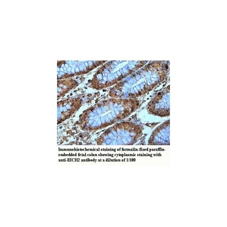 RICH2 Antibody