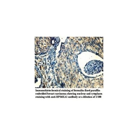 RPS6KA1 Antibody