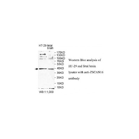 ZSCAN16 Antibody