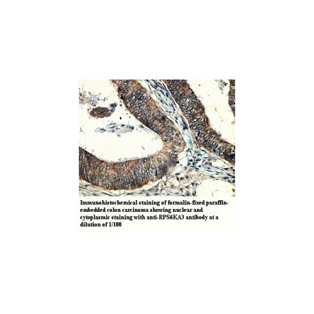 RPS6KA3 Antibody