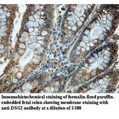 DSG2 Antibody