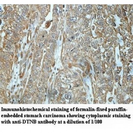 DSG2 Antibody