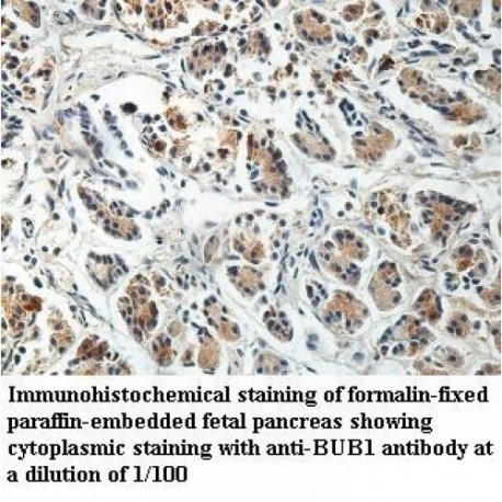 BUB1 Antibody