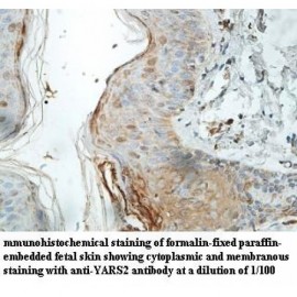 C11orf82 Antibody