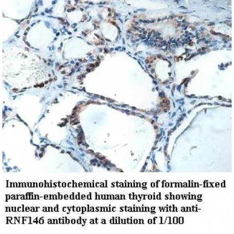 RNF146 Antibody