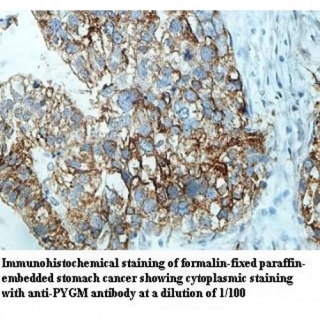 PYGM Antibody