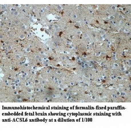 ACSL6 Antibody