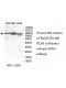 ACSL6 Antibody