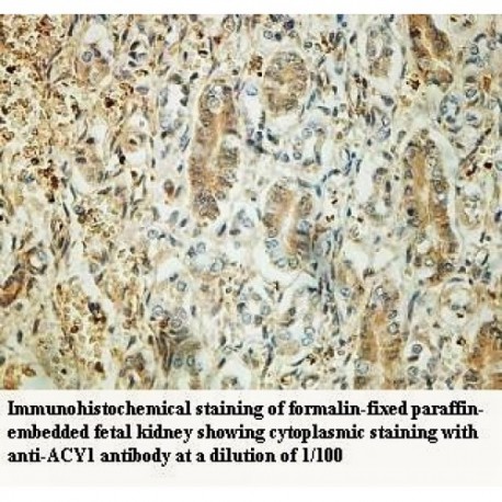 ACY1 Antibody