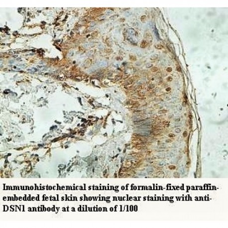 DSN1 Antibody