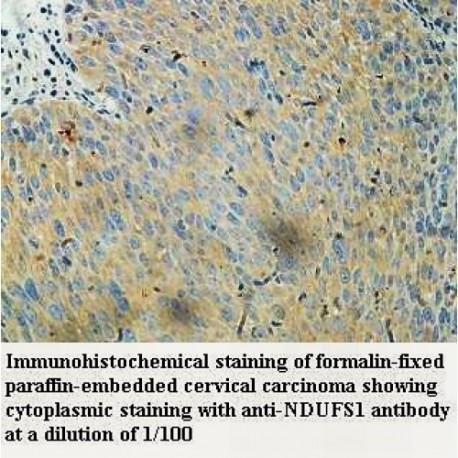 NDUFS1 Antibody