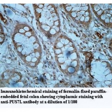 PUS7L Antibody