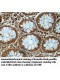 YARS Antibody