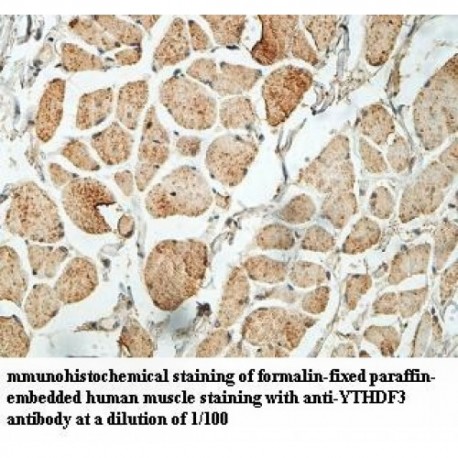 YTHDF3 Antibody