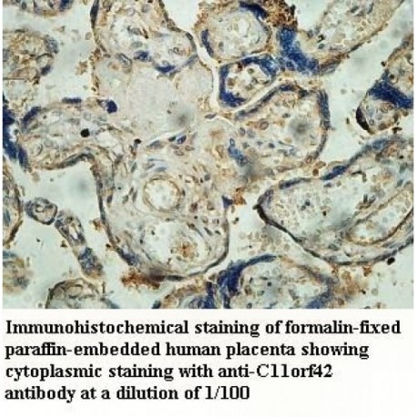 C11orf42 Antibody