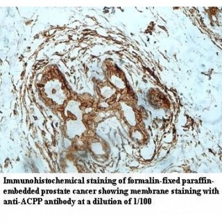 ACPP Antibody