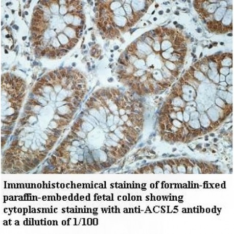 ACSL5 Antibody