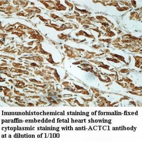 ACTC1 Antibody