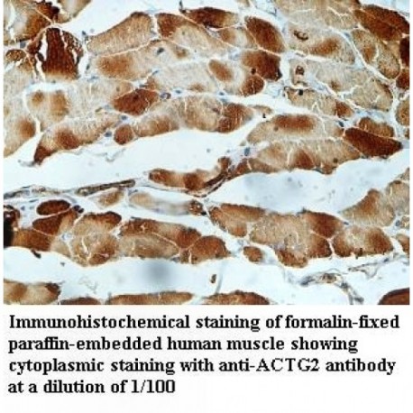 ACTG2 Antibody