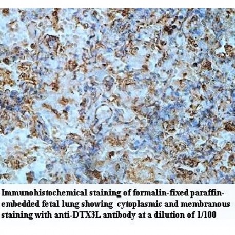 DTX3L Antibody