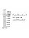 DTX3L Antibody