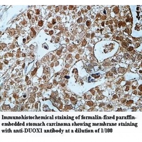 DUOX1 Antibody