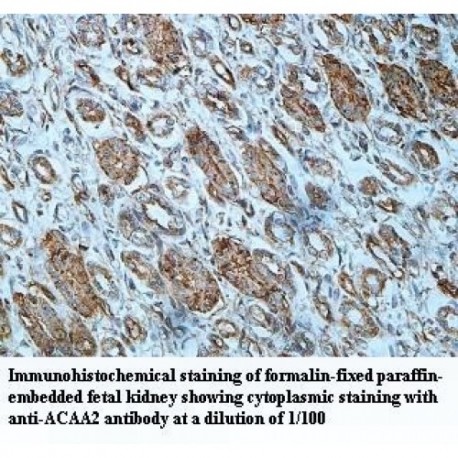 ACAA2 Antibody