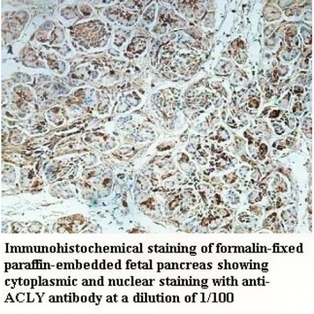 ACLY Antibody