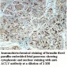 ACLY Antibody
