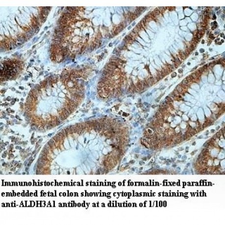 ALDOA Antibody