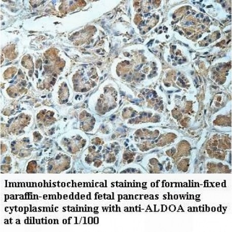 ALDOA Antibody