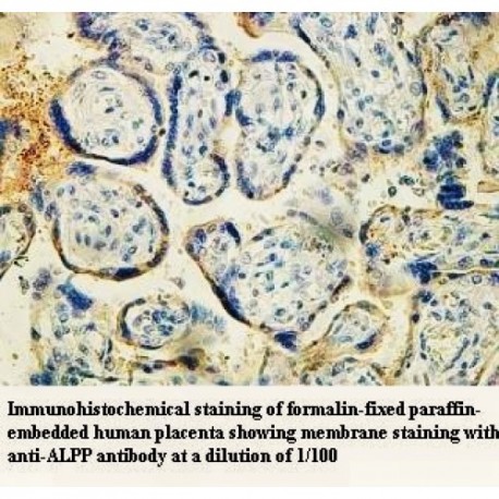 ALPP Antibody