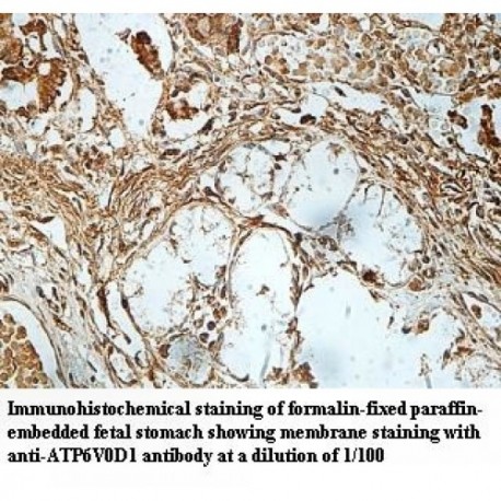 ATP6V0D1 Antibody