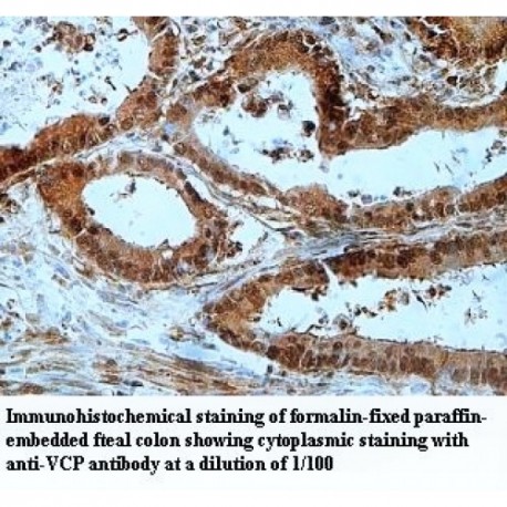 VCP Antibody