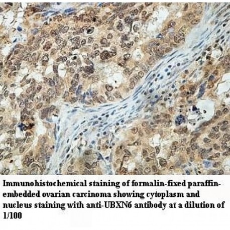 UBXN6 Antibody