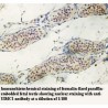 UIMC1 Antibody