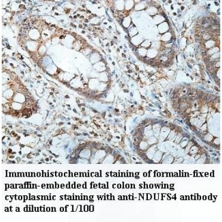 NDUFS4 Antibody