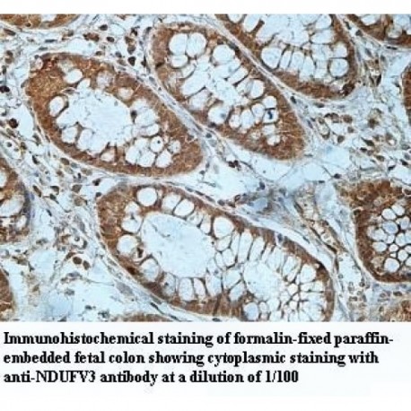 NDUFV3 Antibody