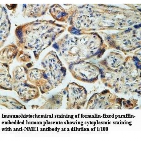 NME1 Antibody