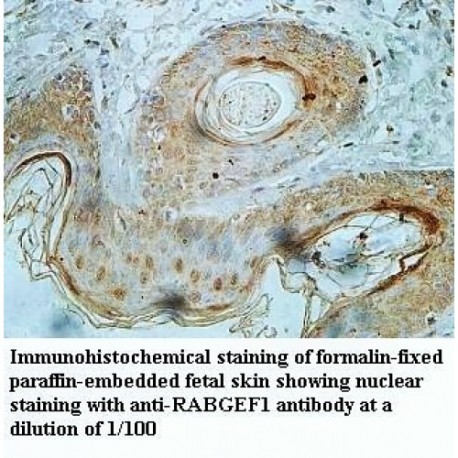 RABGEF1 Antibody