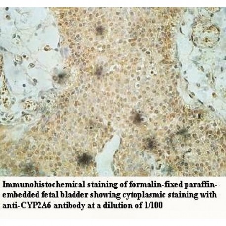 CYP2A6 Antibody