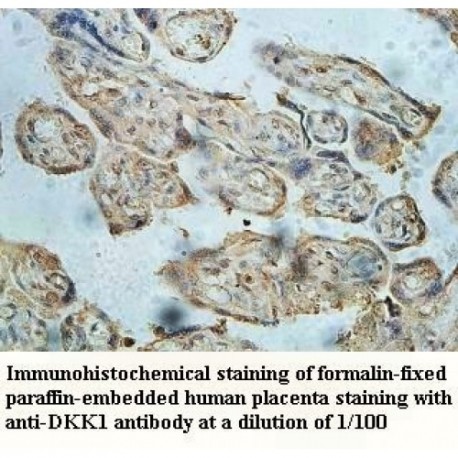 DKK1 Antibody