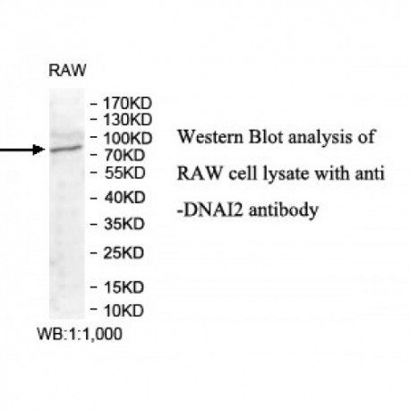 DNAI2 Antibody